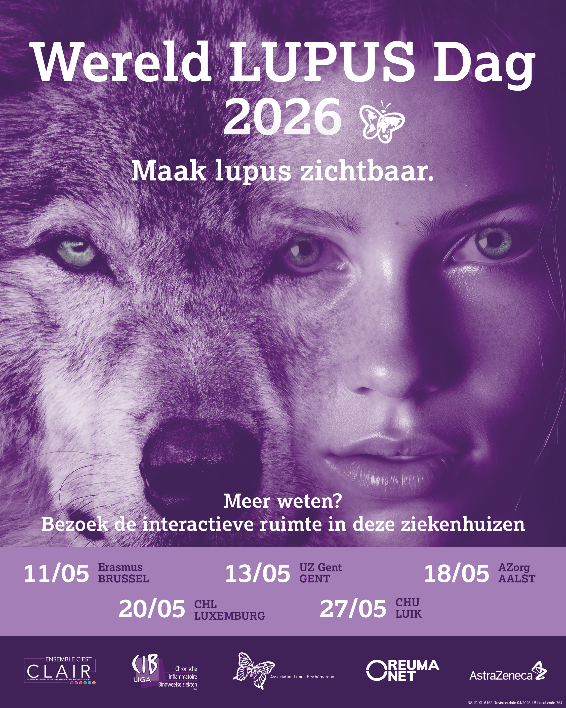 Lupus