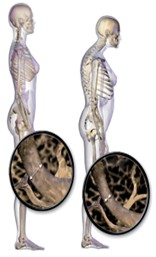 osteo
