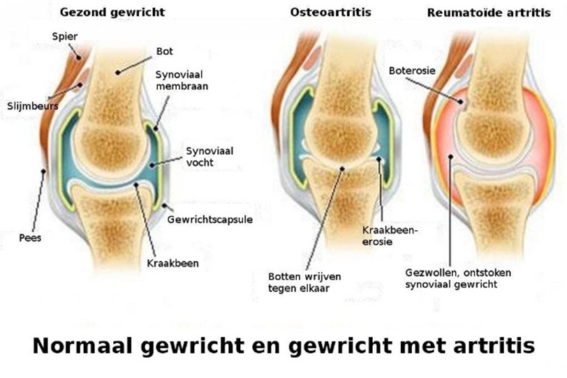 gewricht