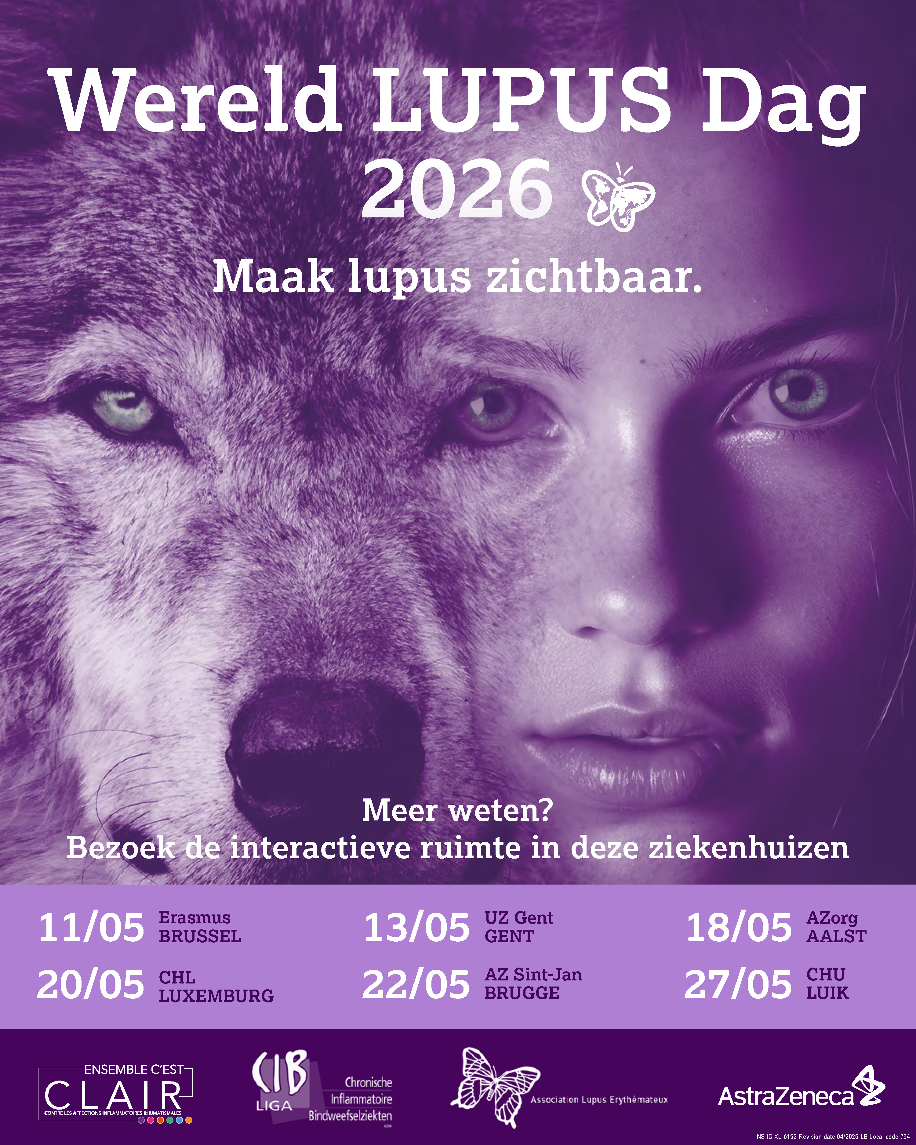 Lupus